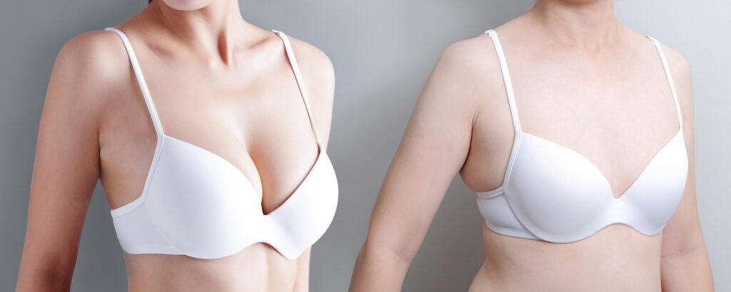 woman with different chest cup