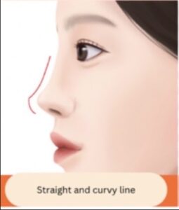 ทำศัลยกรรมจมูกที่เกาหลี