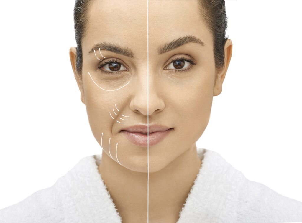 ยกกระชับหน้าที่เกาหลี ดึงหน้า ยกกระชับใบหน้า ยกกระชับหน้าที่เกาหลี ดึงหน้า