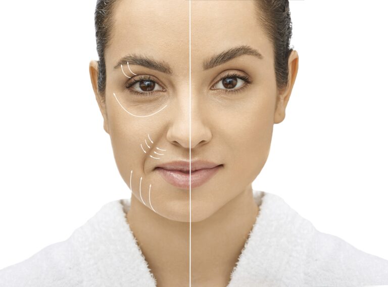 ยกกระชับหน้าที่เกาหลี ดึงหน้า