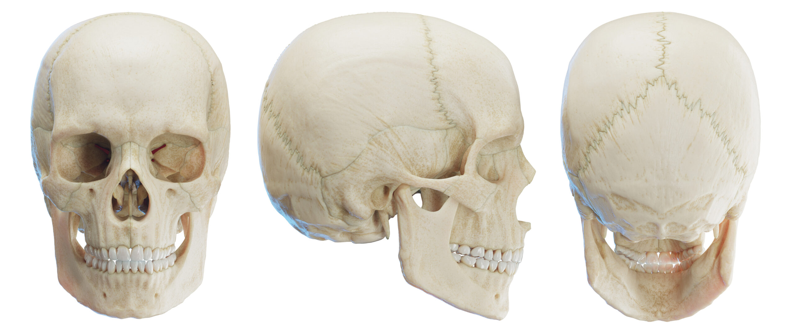 หลังศัลยกรรม โครงหน้าขากรรไกร Skull, illustration