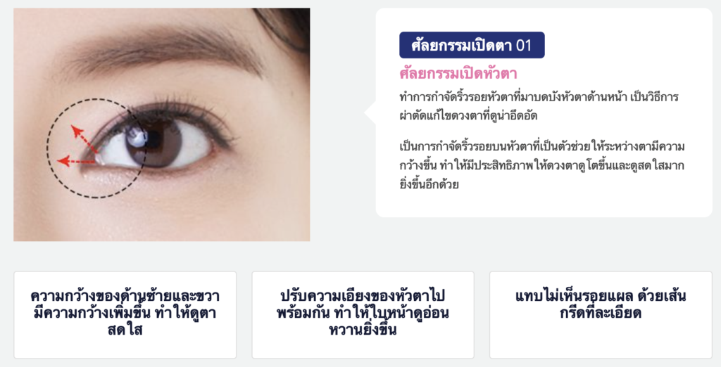 ศัลยกรรมเปิดตา ศัลยกรรมเปิดหัวตา