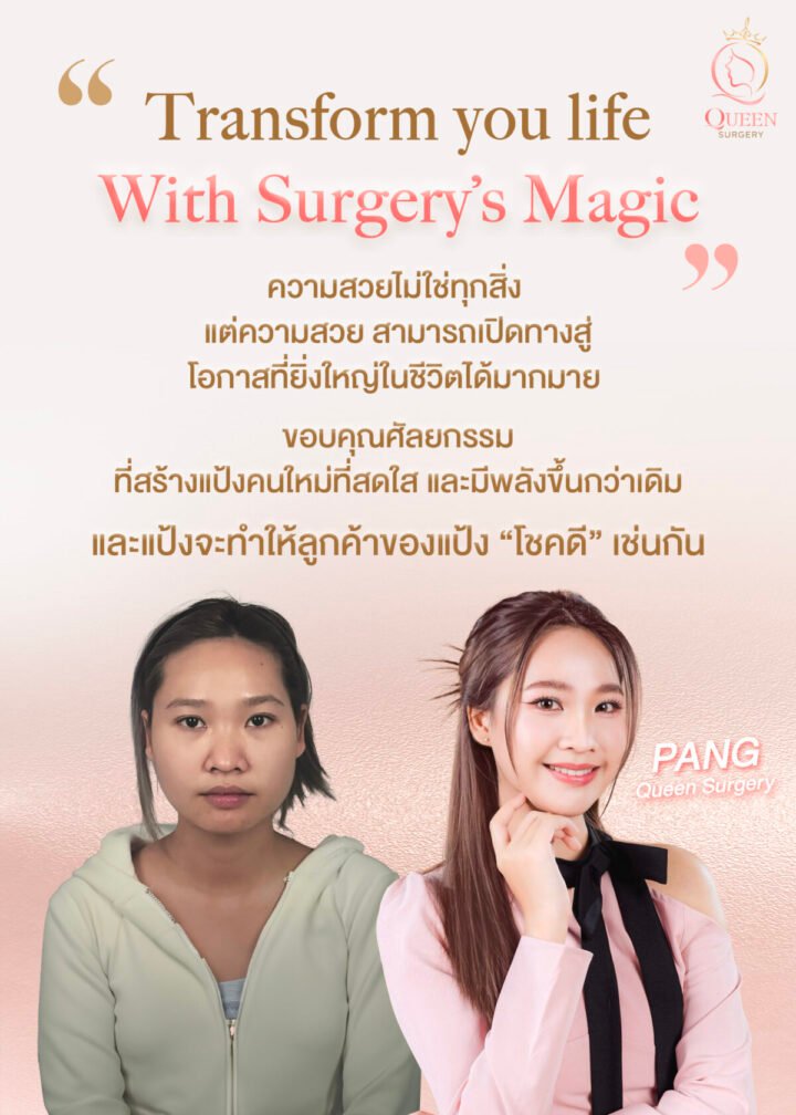 ศัลยกรรมเกาหลี ราคาดี queen surgery banner mobile Transform your Life Surgery Magic 03