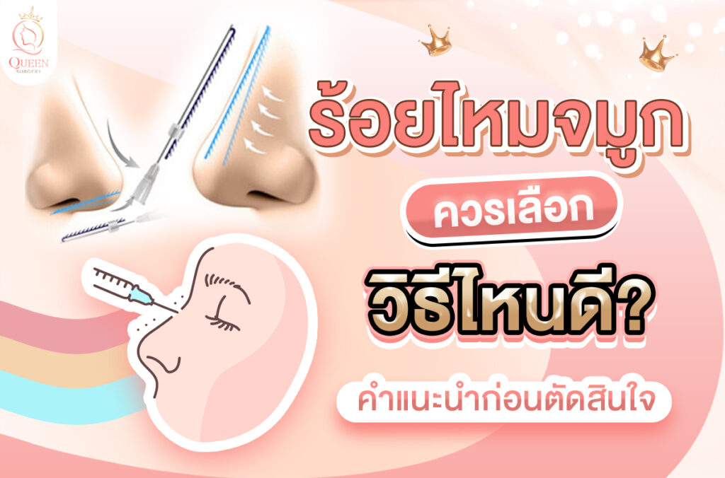 ร้อยไหมจมูก เลือกวิธีไหนดี ศัลยกรรมจมูก ทำจมูก