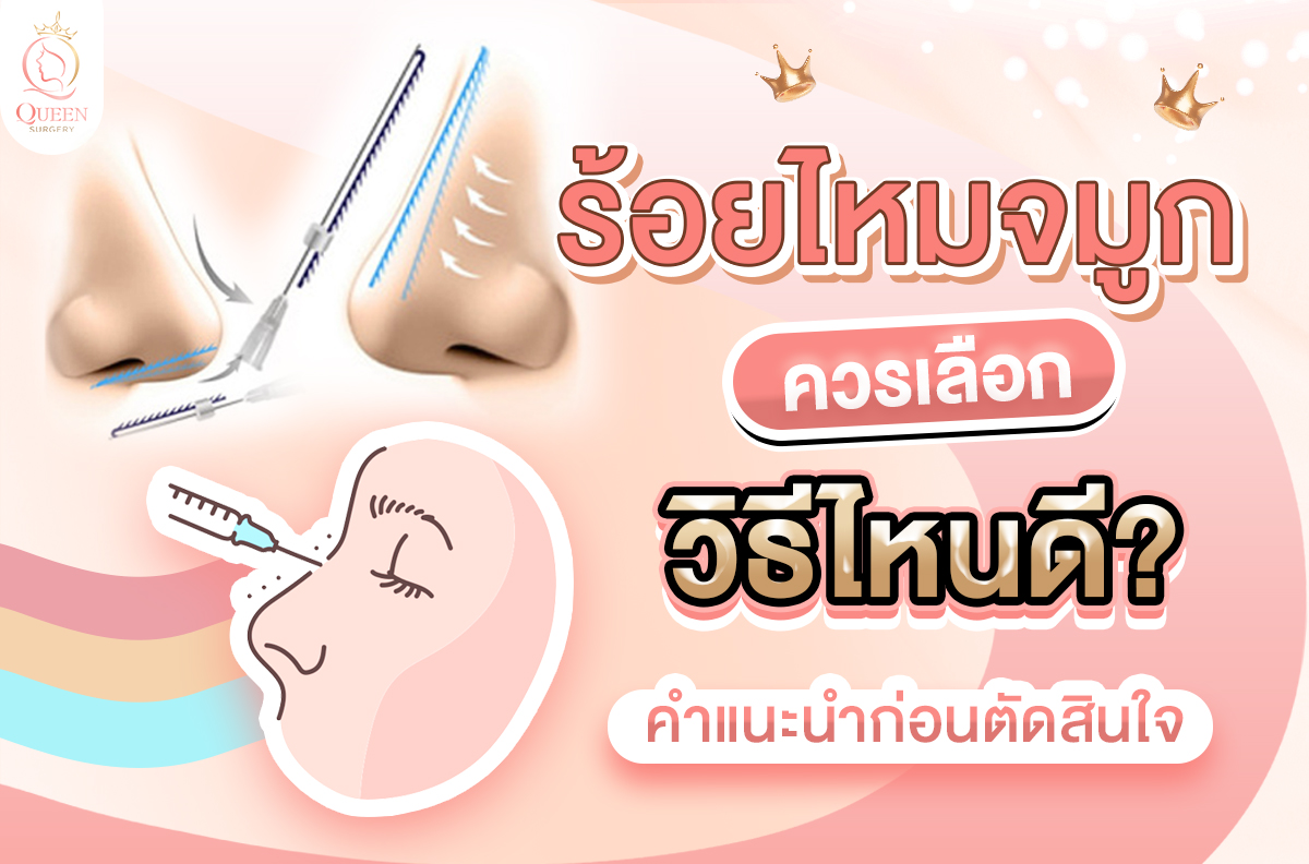 ร้อยไหมจมูก เลือกวิธีไหนดี ศัลยกรรมจมูก ทำจมูก