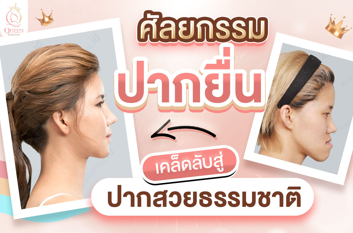 ศัลยกรรมปากยื่น เคล็ดลับให้ปากสวยธรรมชาติ 01