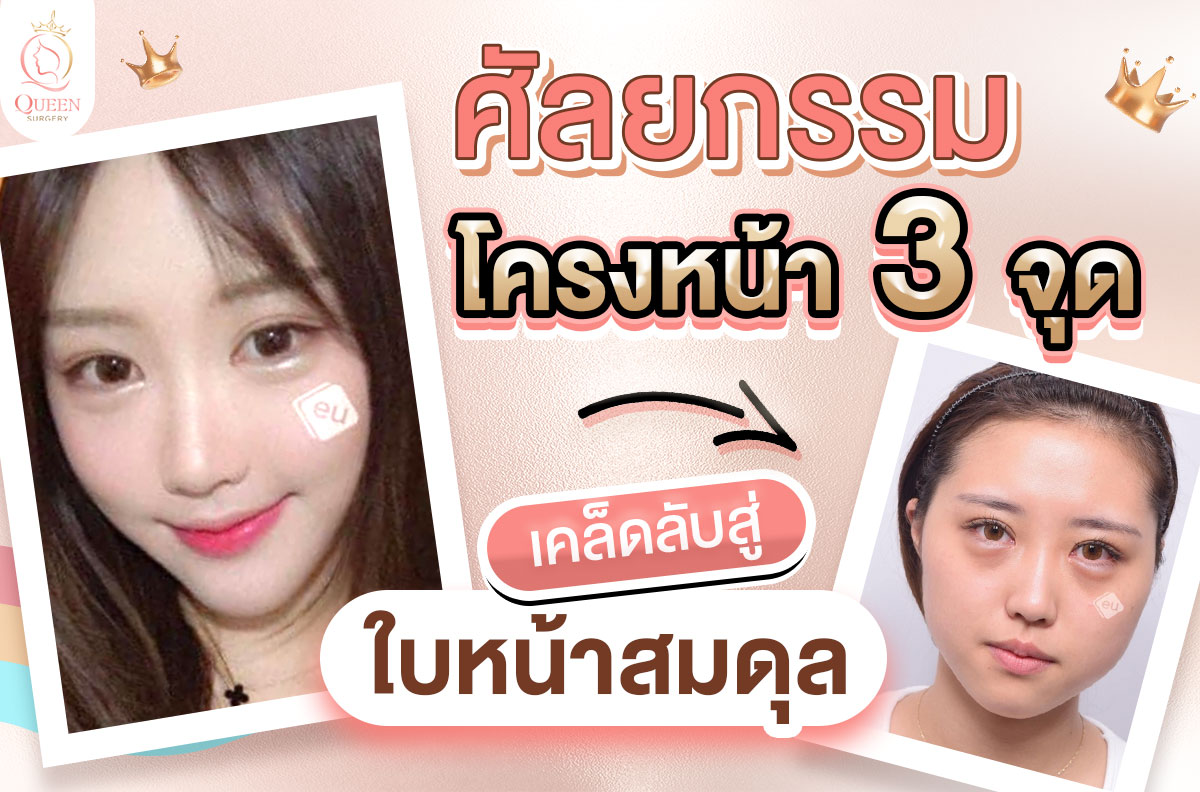 ศัลยกรรมโครงหน้า 3 จุด เคล็ดลับสู่ใบหน้าสมดุล 01