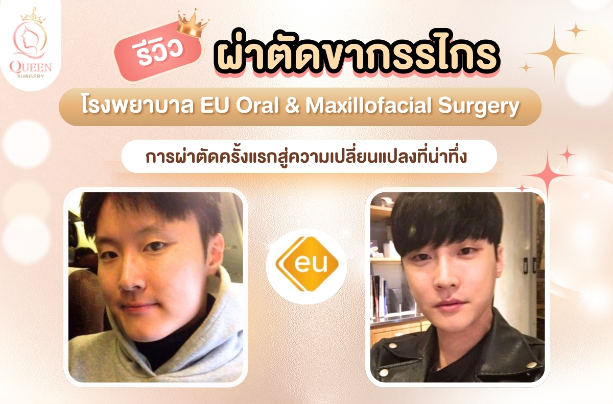 ผ่าตัดขากรรไกรที่โรงพยาบาล EU รีวิว