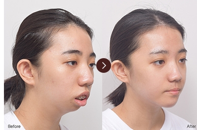สกรีนช็อต 10 9 2024 255 eudental.co.kr