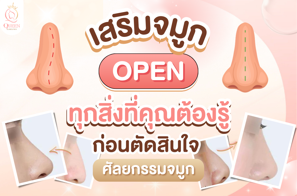 เสริมจมูกแบบ open