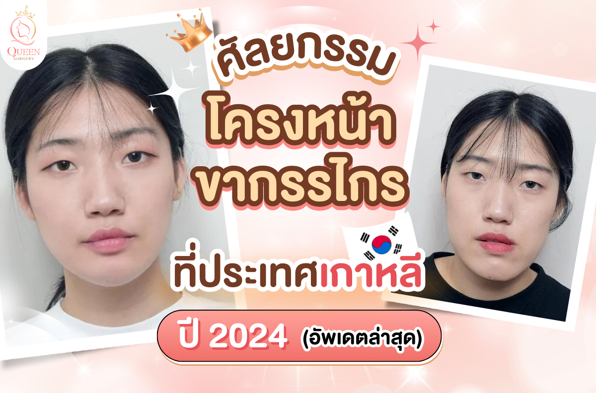 ศัลยกรรมโครงหน้าขากรรไกร ที่เกาหลี