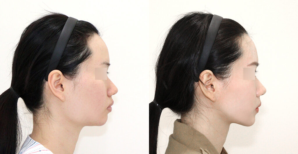 0211e9a906e9620bebff4349286232cc water c0 w1200 h624