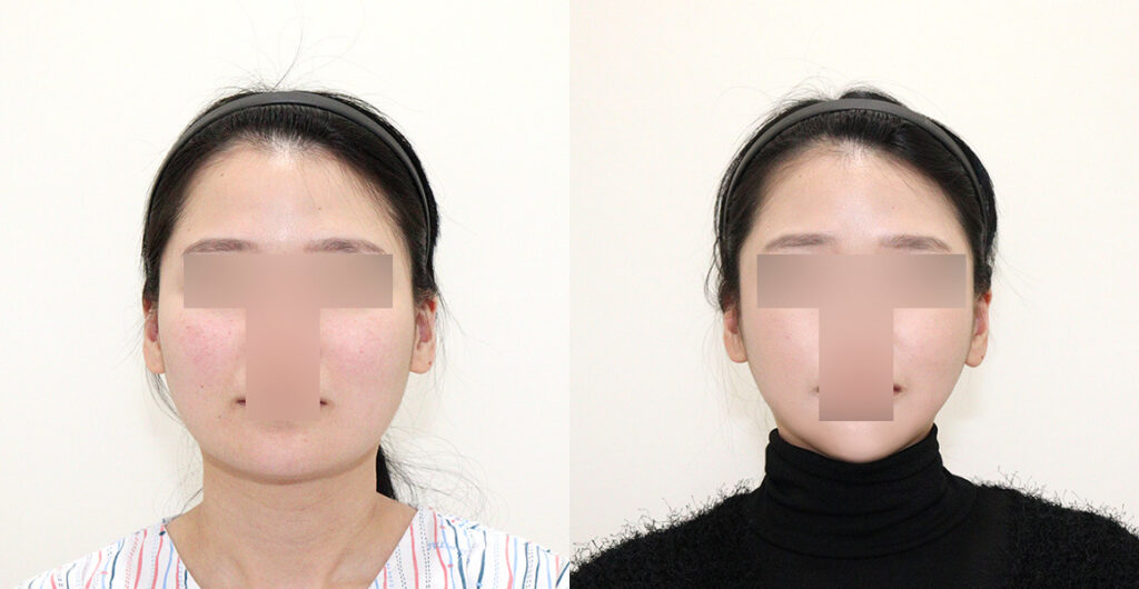 10ff3296424077fb6bc43e17bf1fc2e3 water c0 w1200 h624