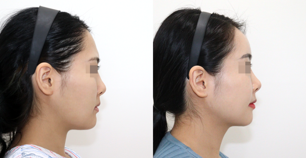 246aa248bd16f7958371202a0c8e0e43 water c0 w1200 h624