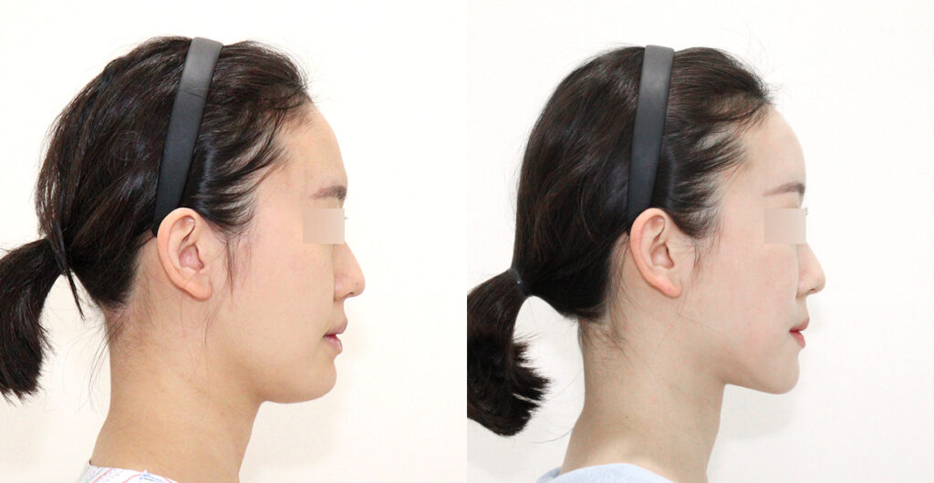 31a03aada598d3ba41b5d3700c68f572 water c0 w1200 h624