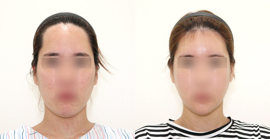 33dbf17f9e0c66683d2cc8c097b85ee2 water c0 w1200 h624