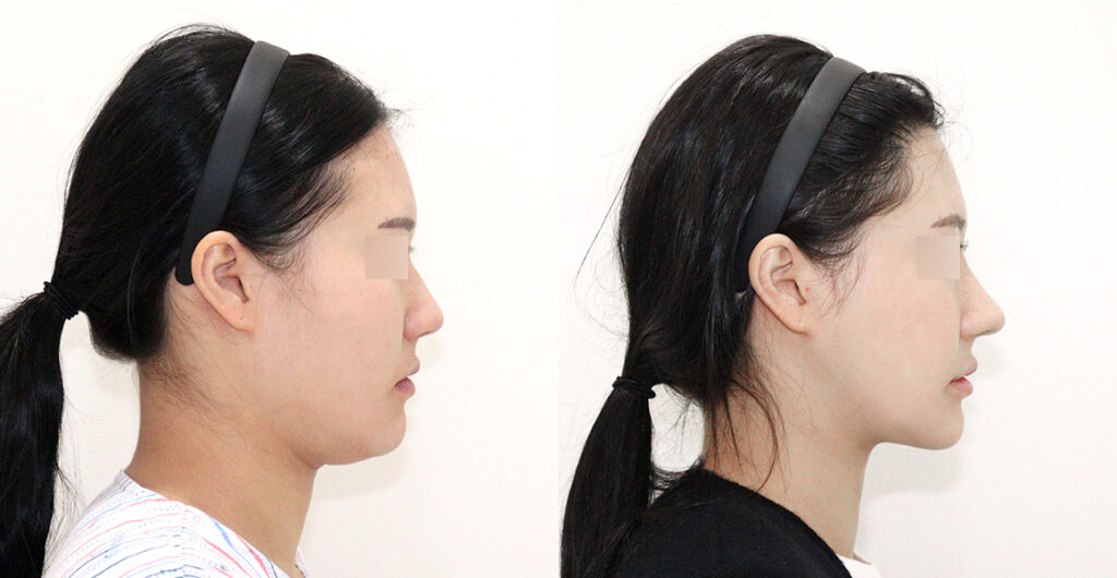 38ca85c920b2713dafec8c1379244e4c water c0 w1200 h624