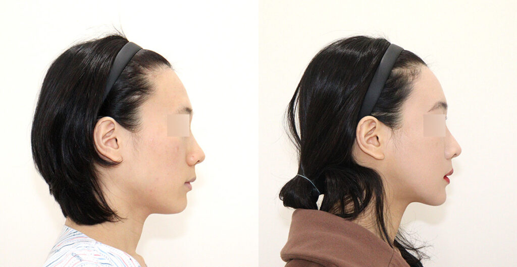 466bd8746172feb0dd7eaf1d645c562f water c0 w1200 h624