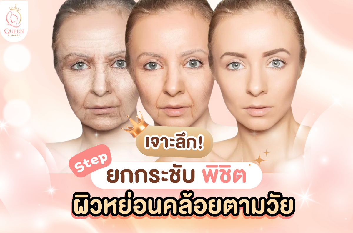 ยกกระชับผิวหย่อนคล้อย