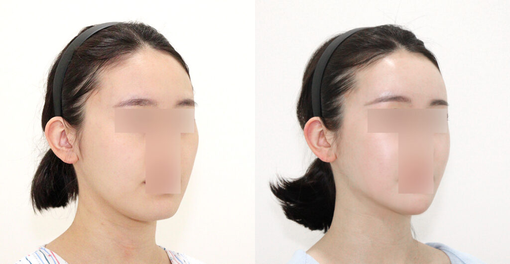 5a519371e5cb430081bf16ba9a574850 water c0 w1200 h624