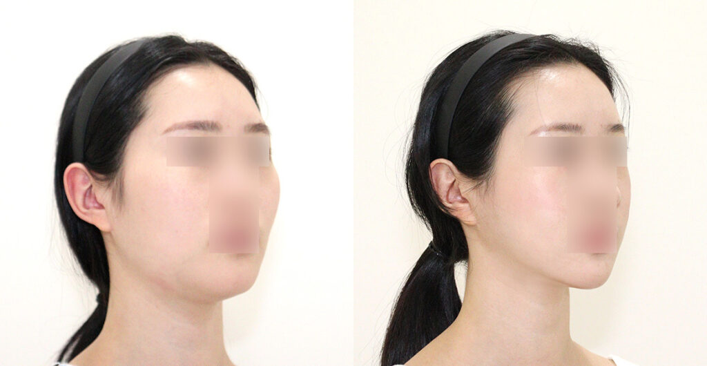 6d9b7170e537e3e9557a9d20c58d5868 water c0 w1200 h624