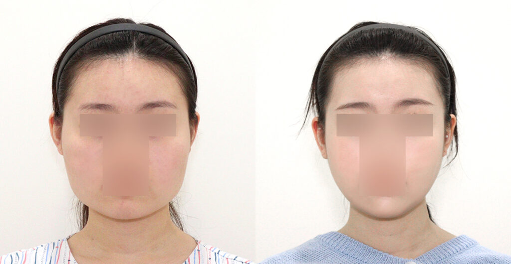 9a600f313e98862a074f588a2612a144 water c0 w1200 h624