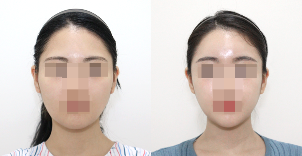 9c7cb010594b0c5e04093ddecd10dc61 water c0 w1200 h624