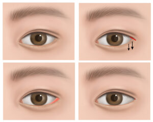 CK tc06120000158 CK tc06120000158