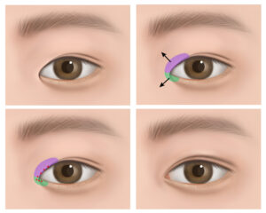 CK tc06120000159 CK tc06120000159