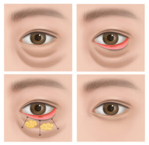 CK tc06120000189 (1) CK tc06120000189 (1)