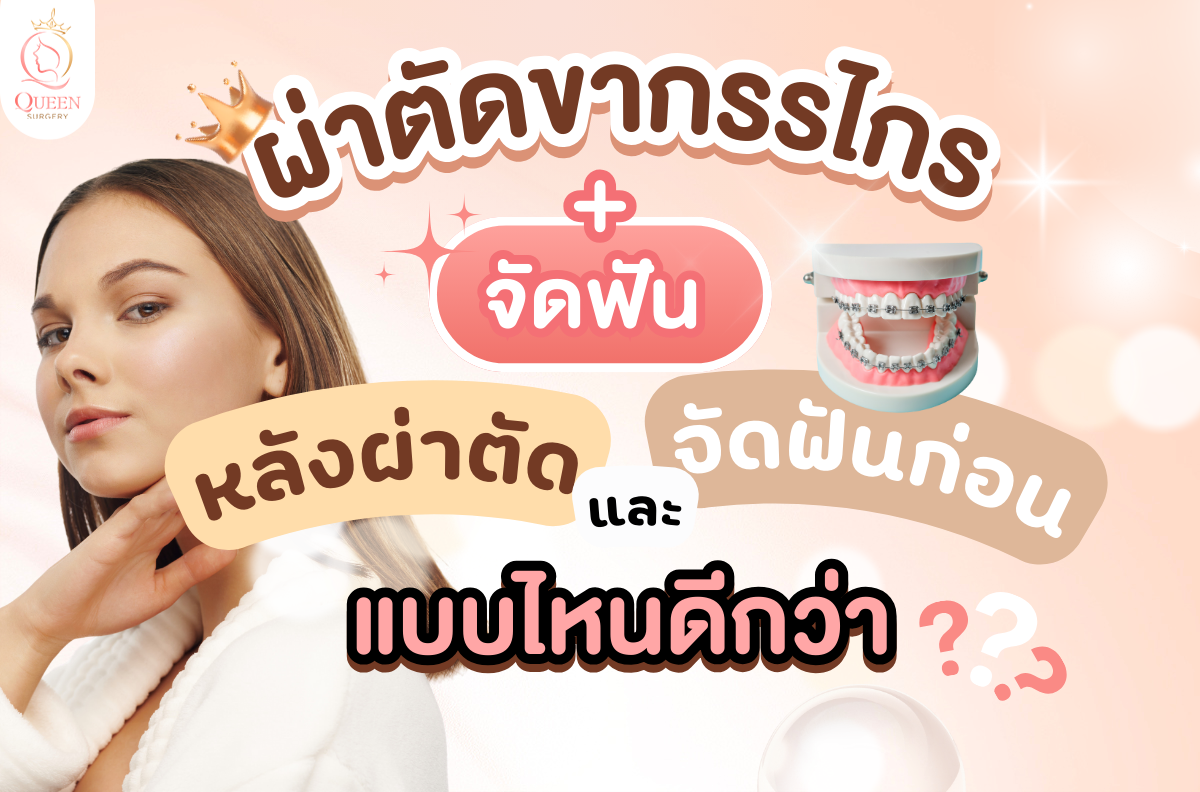 ผ่าตัดขากรรไกรและจัดฟัน