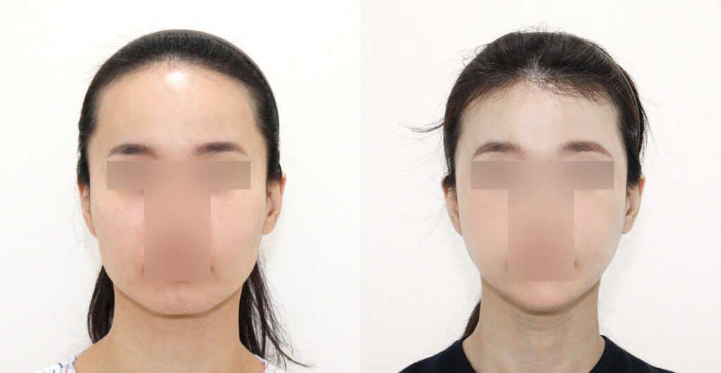 a70a2547f6579fc8d5ab1efa155ea5b1 water c0 w1200 h624