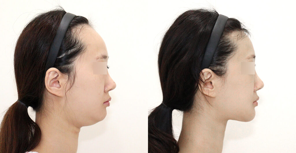 a8be04913245d8847cf76191e7713ec4 water c0 w1200 h624