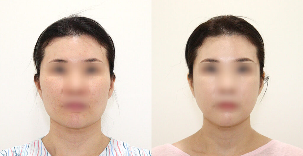 a9551766b90c01f7b22ef21098ab0dc4 water c0 w1200 h624