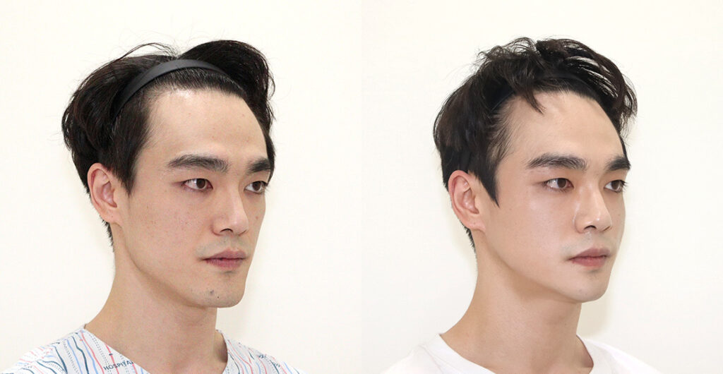 be2338bbf4603632a6a1d7ad6506cfac water c0 w1200 h624