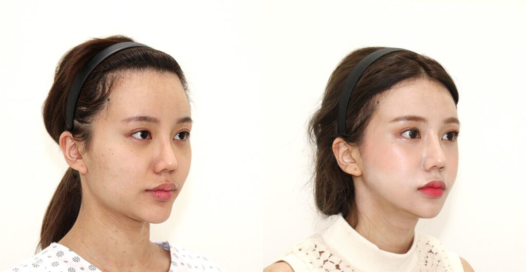 ce44bc1f55d0dcee1088924346a9d5ac water c0 w1200 h624