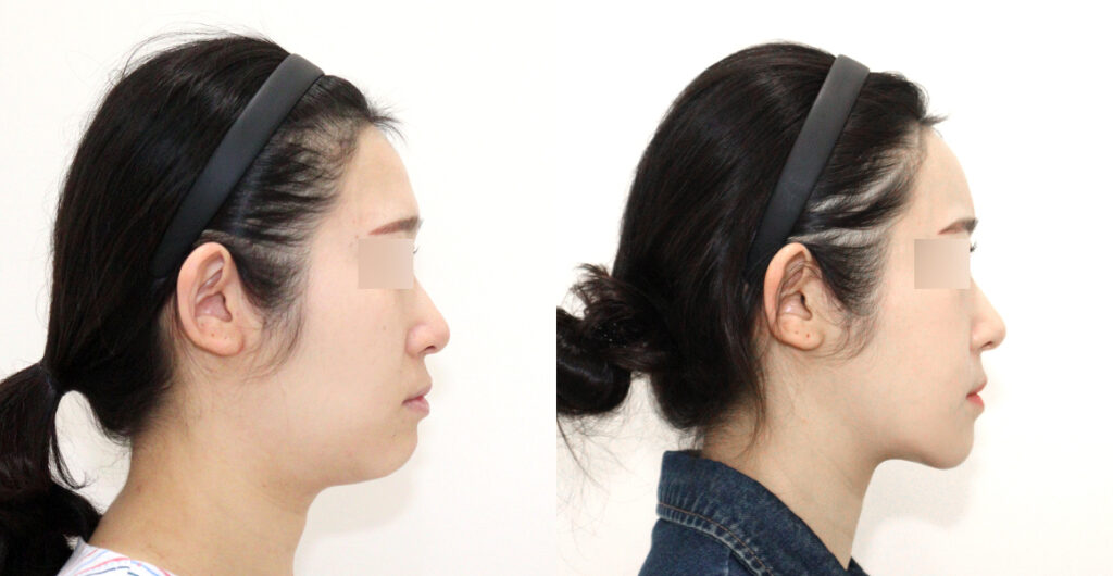 d3b38ee9eb059baeb1ac6fcac54dfdb8 water c0 w1200 h624