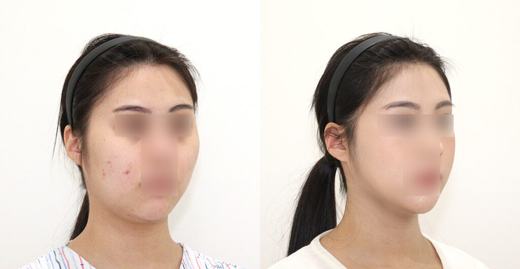 d974eca73b21fe821cd17852ae745ff2 water c0 w1200 h624