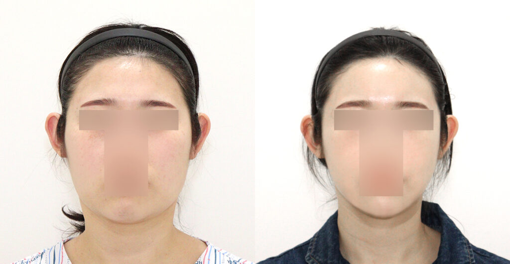 de01126221b64c5a7817072ddf1b0070 water c0 w1200 h624