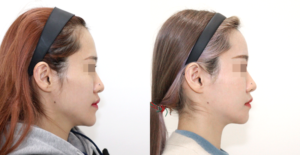 df4d531e6dcd5143703a49fcc33889dc water c0 w1200 h624