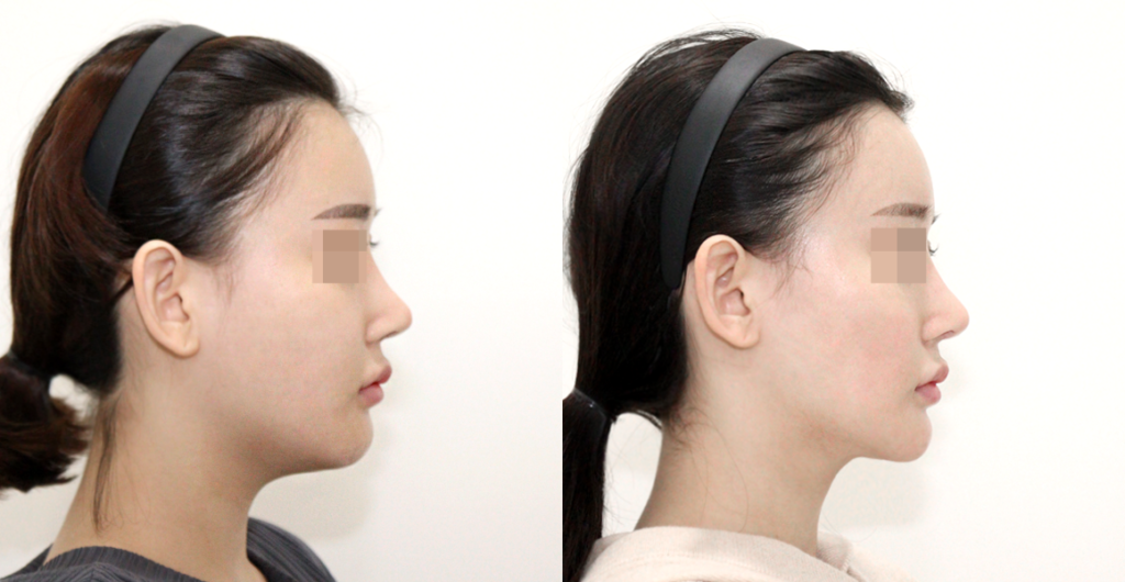 e207fc43da6f9d158af62766e374c6ab water c0 w1200 h624