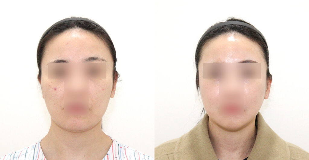 e7bdb35a10f3e74f7436245ec560f53a water c0 w1200 h624