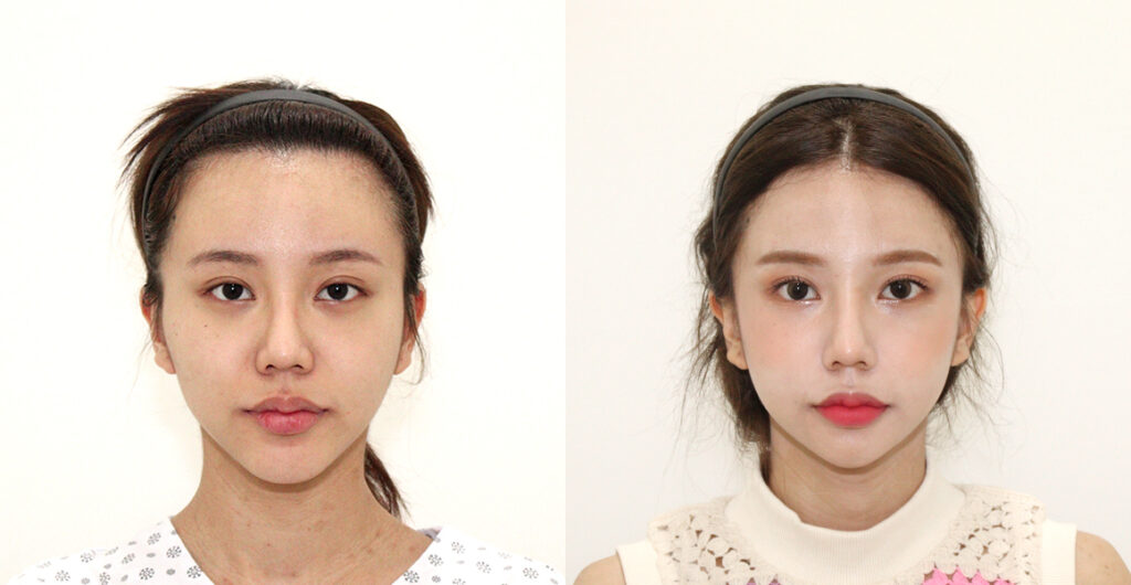 ffd84f6e5805c5efd5c091ad8e838edd water c0 w1200 h624