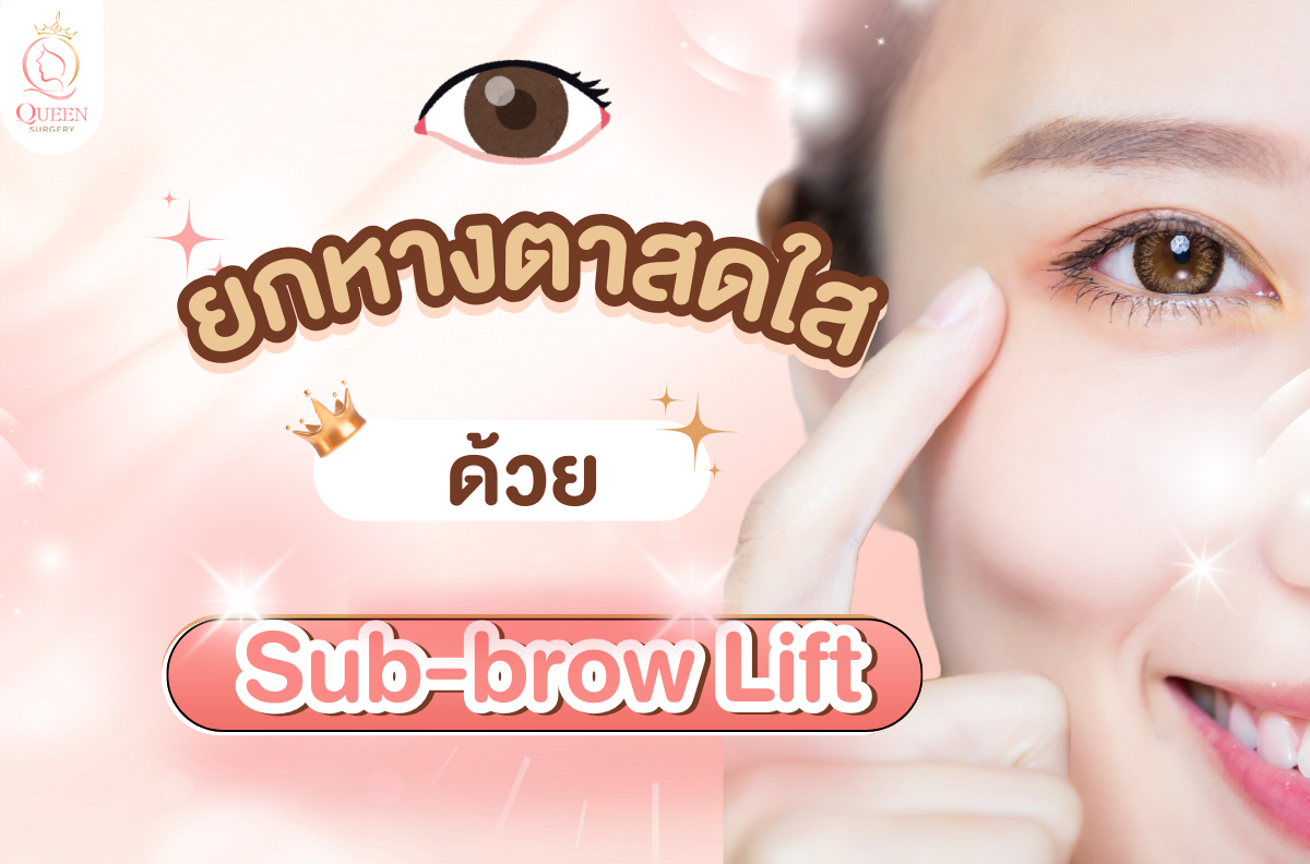 Sub-brow Lift ยกหางตา