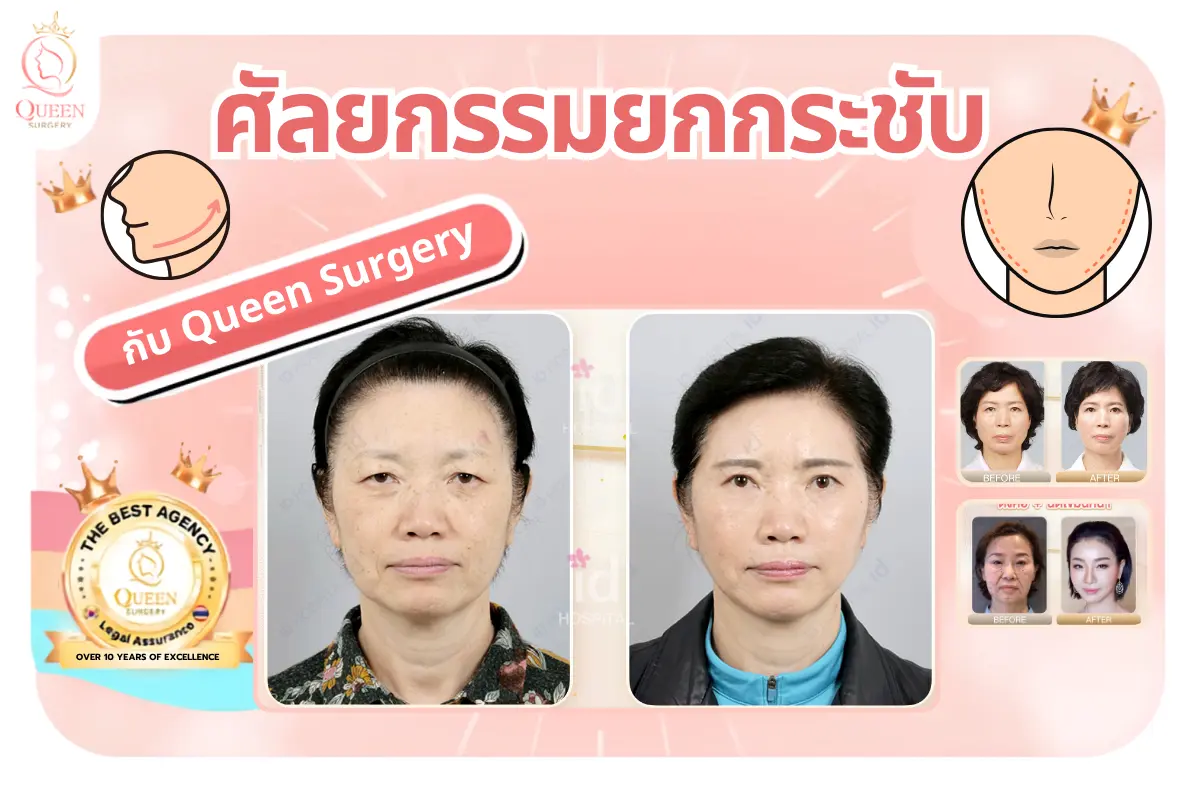 ศัลยกรรมยกกระชับ ษศฆฏาทวงสาสหก