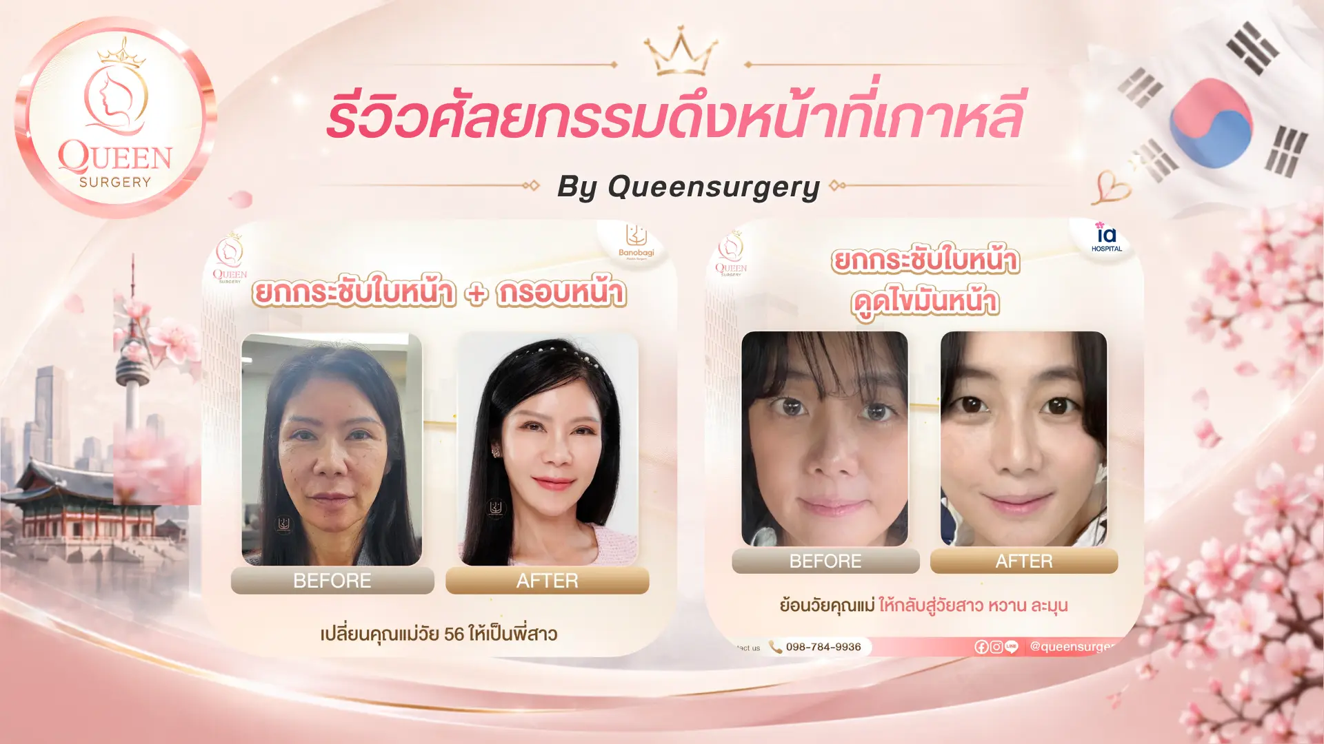 รีวิวการดึงหน้าที่เกาหลี