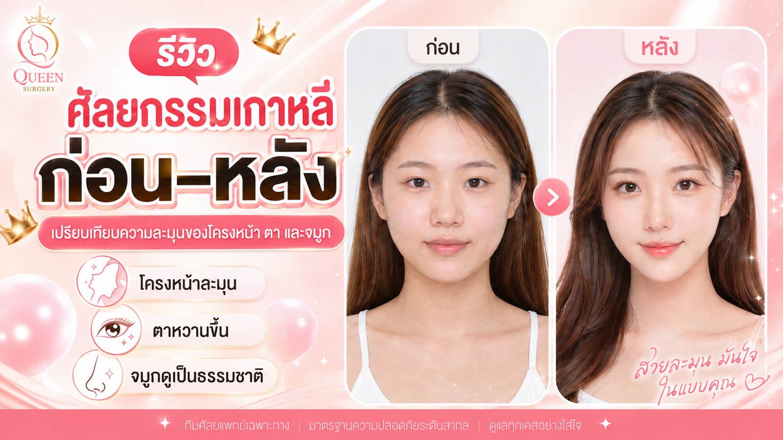 ศัลยกรรมเกาหลีก่อนหลัง 2026