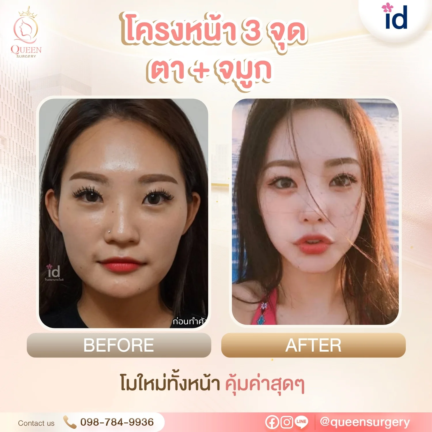 รีวิวการทำหน้าที่เกาหลี ปรับรูปหน้าและย้อนวัยสวยละมุนแบบธรรมชาติ