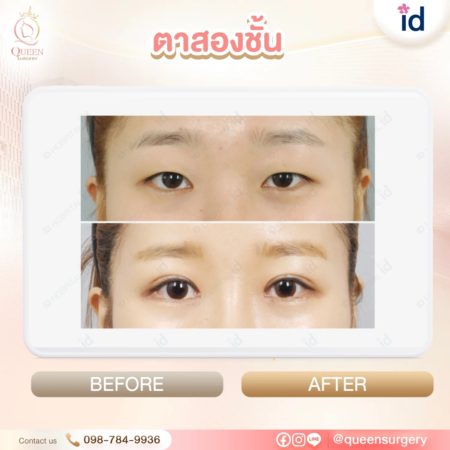 ศัลยกรรมเกาหลีไม่โป๊ะธรรมชาติ