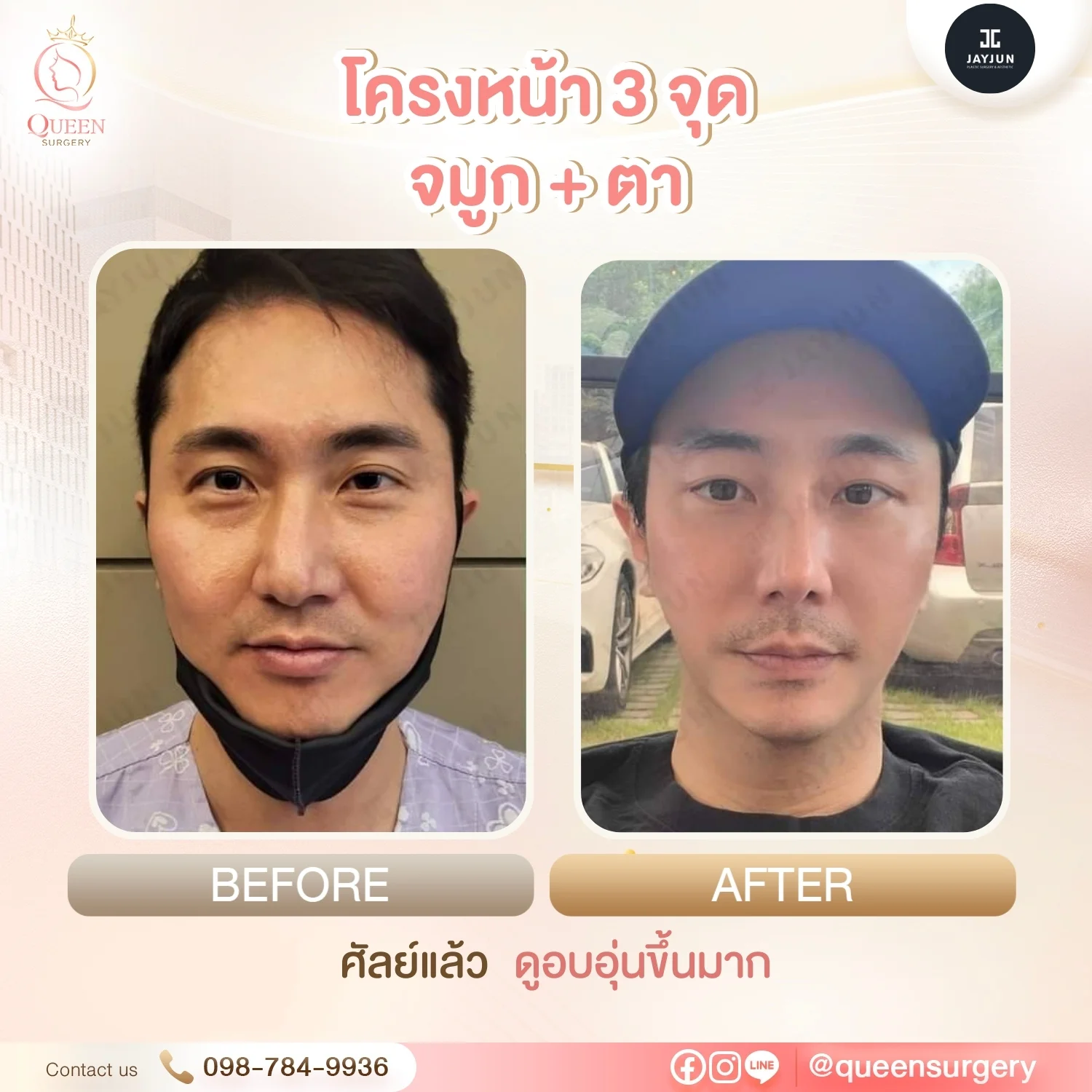 ศัลยกรรมเกาหลีไม่โป๊ะธรรมชาติ